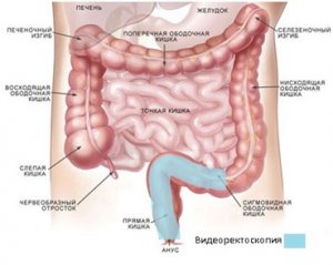 Видеоректороманоскопия в Медицинском центре