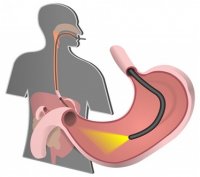ФЭГДС за 3000 рублей! Тест на Хеликобактер пилори – в подарок!