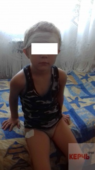 Из-за камней на детской площадке в Керчи пострадал ребенок