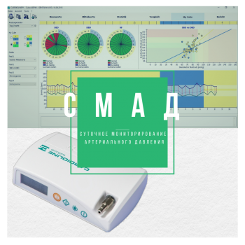 Суточный мониторинг артериального давления – СМАД