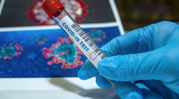 Коронавирус обнаружили у крымчанина в результате тестирования здорового населения