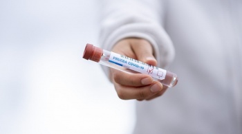 Крым закупит 25 тысяч быстрых тестов на коронавирус