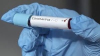 Еще 9 случаев заболевания коронавирусом зарегистрировали в Крыму