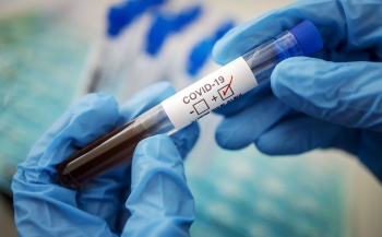 Иностранцам разрешили сдавать тесты на коронавирус уже после приезда в Крым