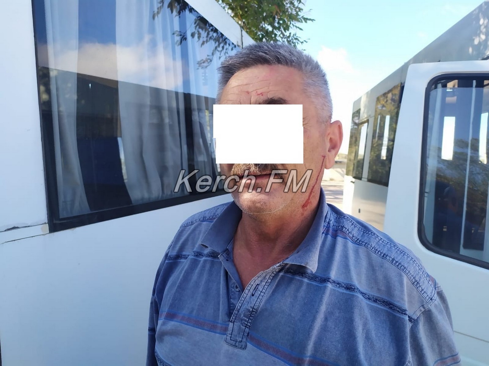 В Керчи пассажирка расцарапала лицо водителю автобуса
