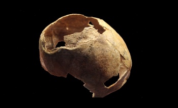 Новости » Общество: В Крыму нашли череп эпохи бронзы со следами прижизненной трепанации