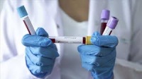 В Крыму выявили 213 зараженных коронавирусом за сутки