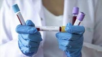 Число умерших от коронавируса в Крыму с начала пандемии превысило 2 тысячи