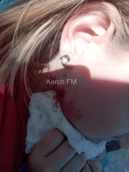 Новости » Криминал и ЧП: Опасное ограждение: ребенок в Керчи пострадал на новой детской площадке в Капканах