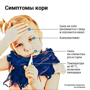 Число случаев заболевания корью в Крыму превысило два десятка впервые за 10 лет