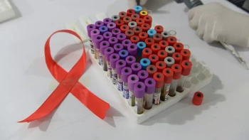 Новости » Общество: ВИЧ-инфекцию в Крыму стали чаще выявлять у благополучных граждан старше 40 лет